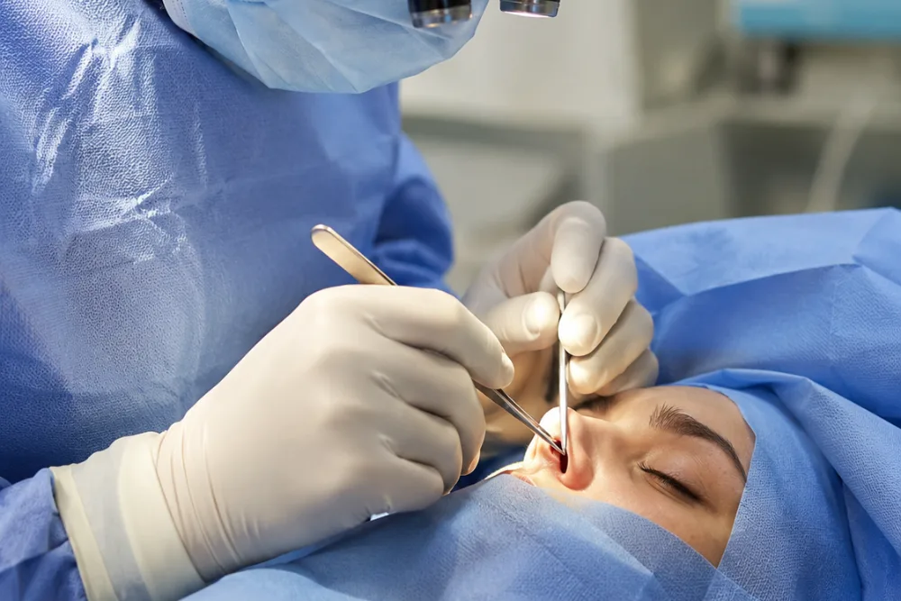 Septumplastia